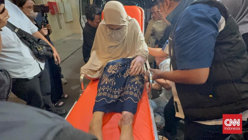 Oknum Polisi Sekap Wanita Siram Air Keras di Jateng